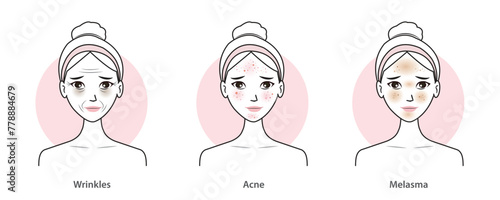 Infographic of skin problems set vector illustration isolated on white background. Cute women with wrinkles, aging, dark circles, acne, scar, melasma, hyperpigmentation and dark spots on faces. 
