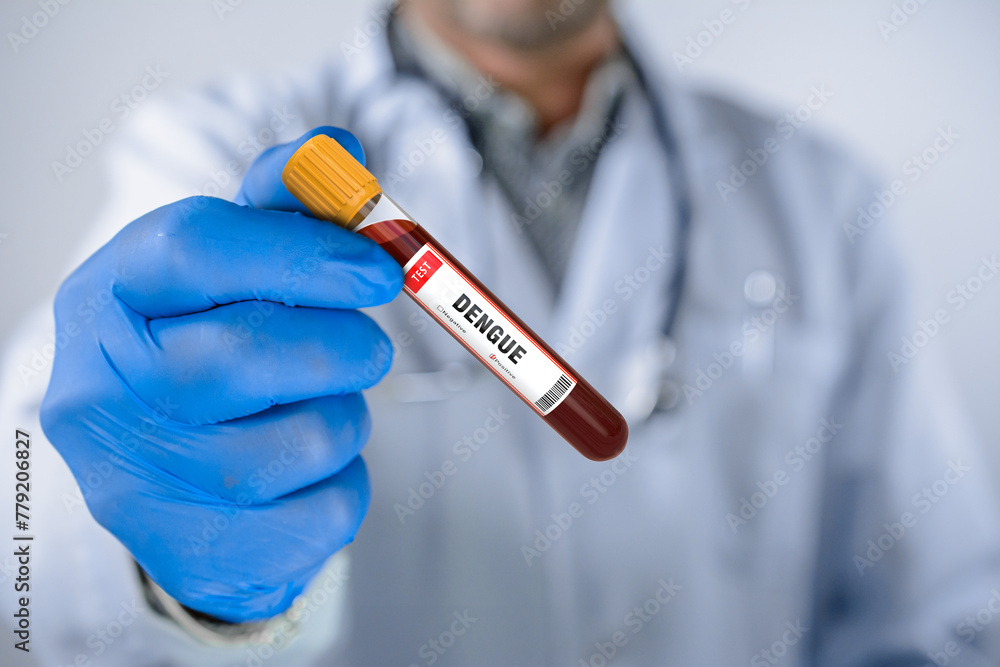 Blood Sample Positive with Dengue Virus Test Blood Sample Positive with Dengue Virus Test