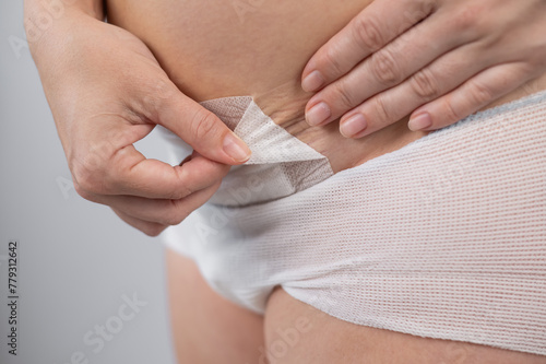 A woman tears a patch from a stitch after a caesarean section.