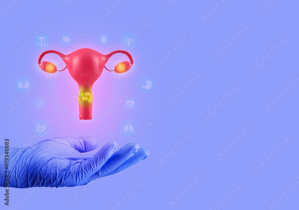 Cervical cancer concept, the uterus with damaged tissue. Doctor's hand shows female reproductive system isolated. Awareness to get the Pap test done. Isolated on light violet background - obrazy, fototapety, plakaty 