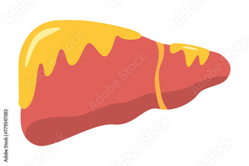 fatty liver disease. vector illustration