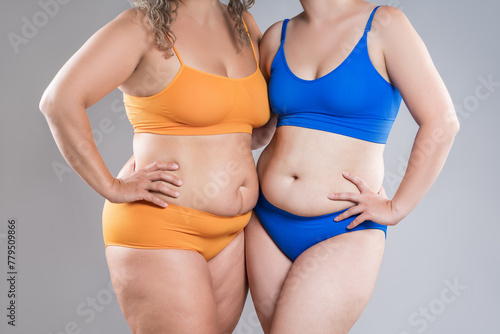 Two overweight women with cellulitis, fat flabby bellies, legs, hands, hips and buttocks on gray background, obese female body, liposuction and plastic surgery concept © staras