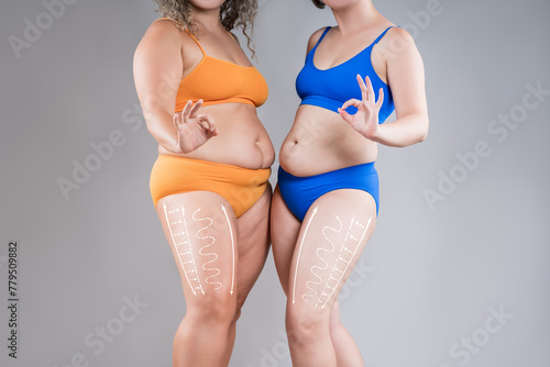 Two overweight women with cellulitis show ok, fat flabby bellies, legs, hands, hips and buttocks on gray background, obese female body, liposuction and plastic surgery concept photo
