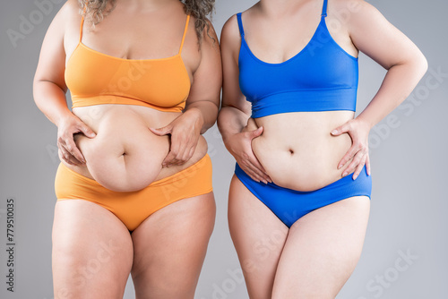 Wallpaper Mural Two overweight women with cellulitis, fat flabby bellies, legs, hips and hands on gray background, obese female body, liposuction and plastic surgery concept Torontodigital.ca