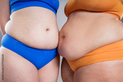 Tummy tuck, two fat women with cellulitis and flabby bellies on gray background, obese female body, plastic surgery and liposuction concept