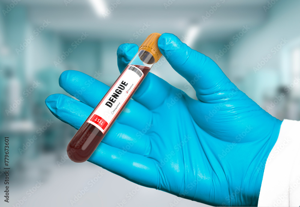 Blood Sample Positive with Dengue Virus Test Blood Sample Positive with Dengue Virus Test