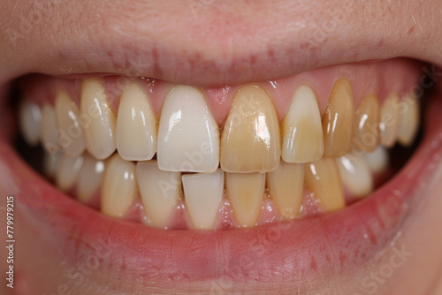 A close up of a person's teeth with a pinkish tint