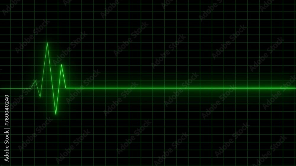 Video Stock ECG cardiogram oscilloscope. Heartbeat line showing.Heart