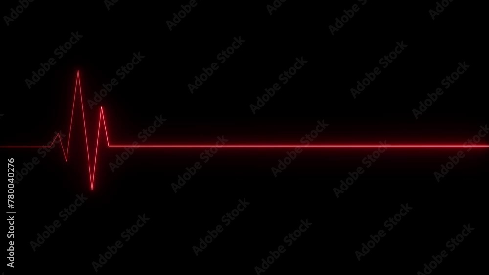 ECG cardiogram oscilloscope. Heartbeat line showing.Heart beat cardiogram. ECG cardiogram oscilloscope. Heartbeat line showing.Heart beat cardiogram.