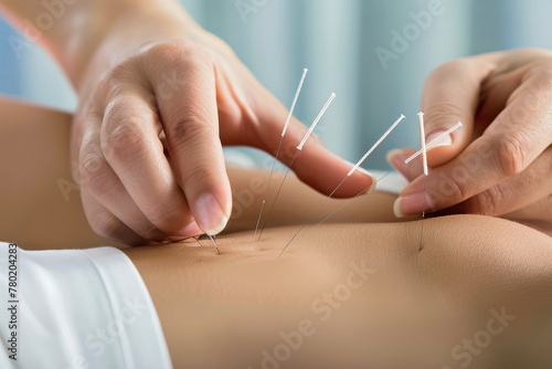 Healing Body and Mind Through Acupuncture Treatment: The Ultimate Relaxation from the Fusion of Tradition and Modern Science photo