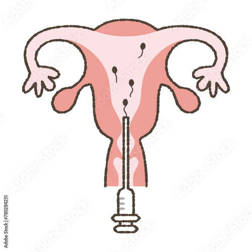 Artificial insemination illustration.
