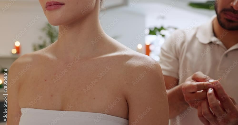 Acupuncture, needle and body in wellness clinic, woman or acupuncturist in health spa for therapy. Holistic healing, healthcare or traditional Chinese practice, pain relief in nervous system Acupuncture, needle and body in wellness clinic, woman or acupuncturist in health spa for therapy. Holistic healing, healthcare or traditional Chinese practice, pain relief in nervous system