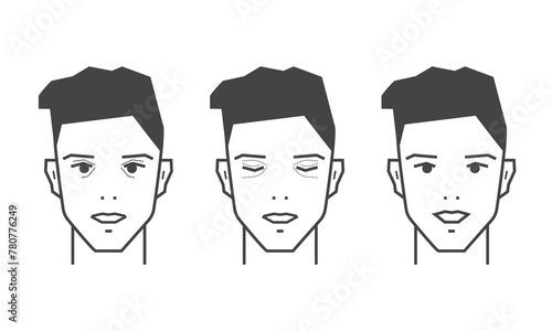 Blepharoplasty icons, plastic surgery concept. Skin correction around the eyes. Vector illustration
