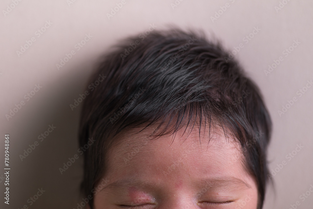 Tiny little newborn human baby head forehead pate Tiny little newborn human baby head forehead pate