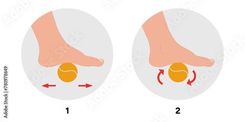 Special exercise for food deformation problem. Orthopedist Therapeutic and strengthening foot with tennis ball
