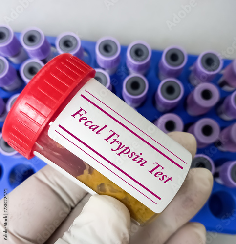 Stool sample in Plastic container for Fecal Trypsin test, Fecal Chymotrypsin test, pancreatic insufficiency. photo