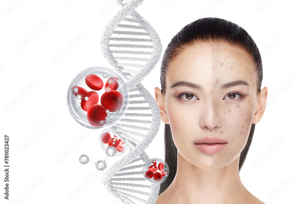 acne treatment concept - obrazy, fototapety, plakaty 