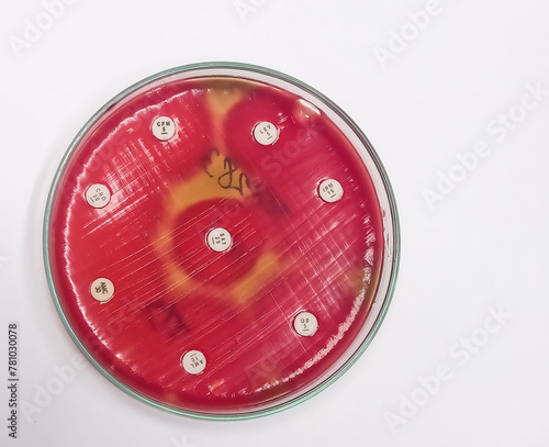 Antimicrobial susceptibility testing in petri dish,Gram-positive coccus,Streptococcus pyogenes or Group A streptococcus (GAS) photo