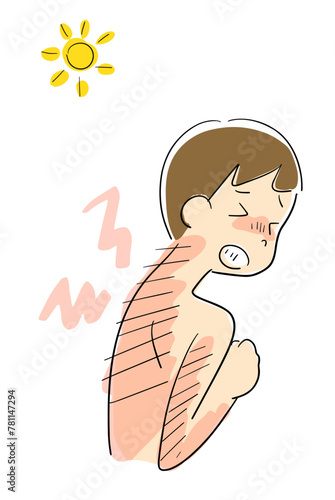 日焼けした背中が痛い男性