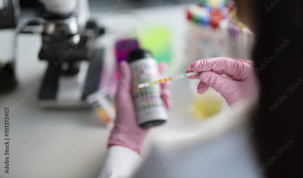 Chemist in the laboratory checks ph strips. Urine analysis control concept
