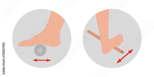 Special exercise for food deformation problem. Orthopedist Therapeutic and strengthening foot with stick and fitness massage roller  