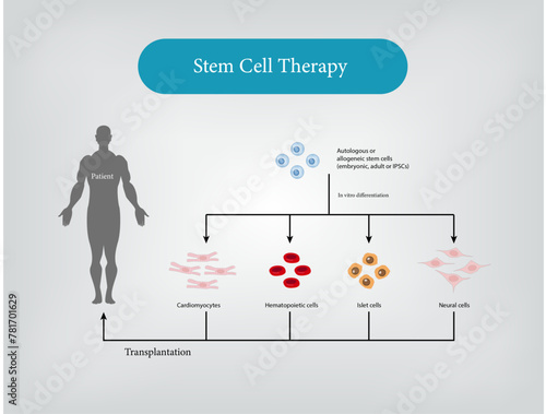 Cancer Stem Cell Therapy Vector and Illustration photo