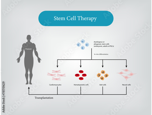 Cancer Stem Cell Therapy Vector and Illustration
