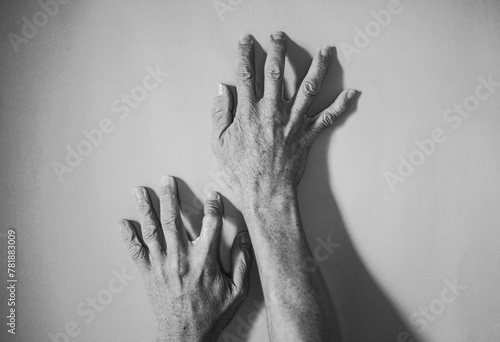 Peripheral neuropathy body parts of elderly people photo