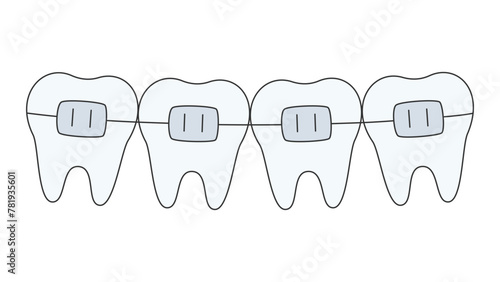 teeth row with braces