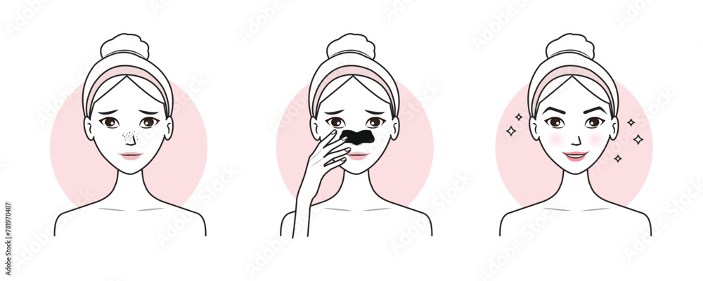 Cute woman with step of blackheads treatment on nose vector illustration isolated on white background. Before and after nose pore strip remove blackheads on face. Skin care and beauty concept. Cute woman with step of blackheads treatment on nose vector illustration isolated on white background. Before and after nose pore strip remove blackheads on face. Skin care and beauty concept.