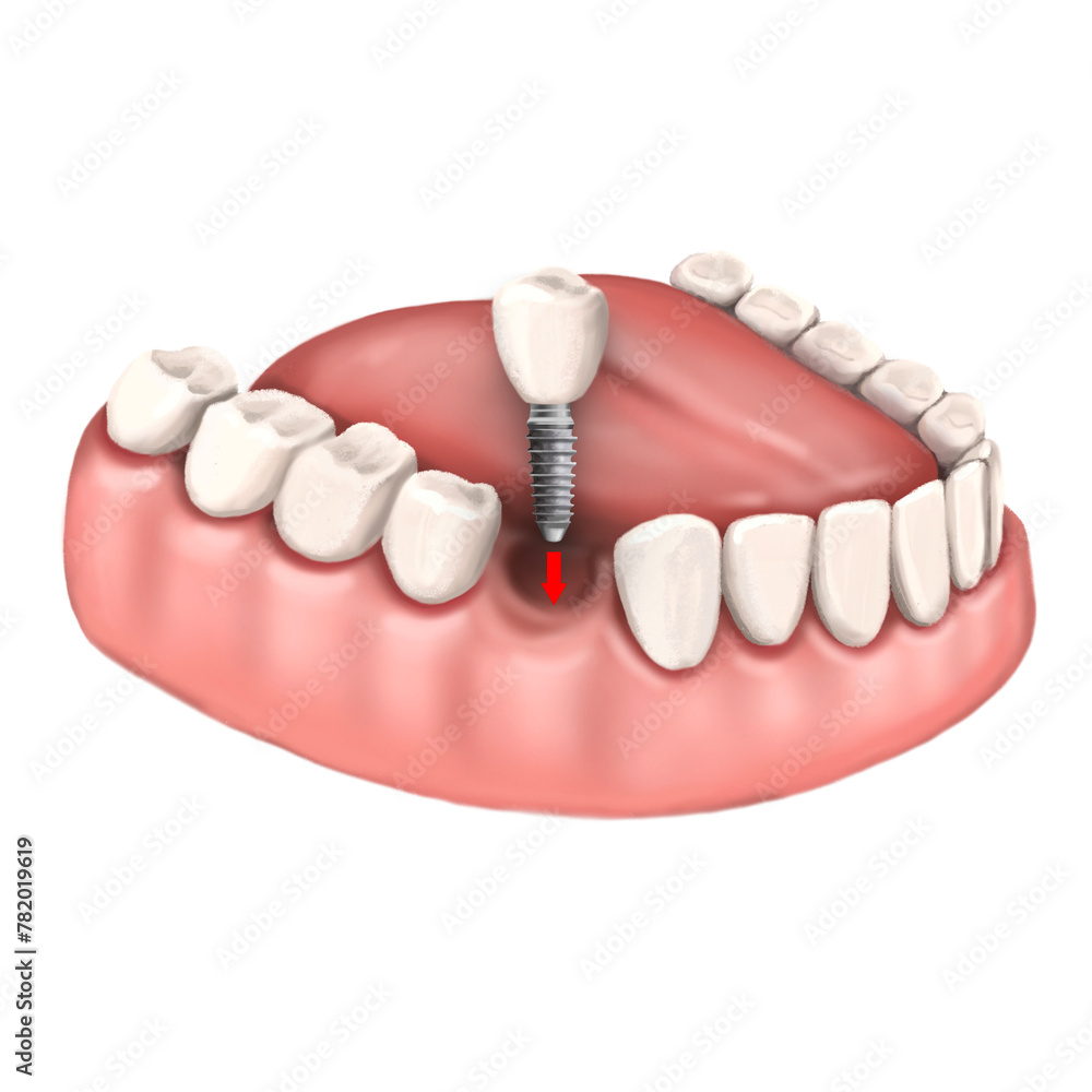 Fototapeta premium teeth and dental tools