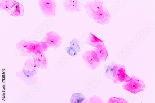 View in microscopic of human skin cells.Squamous epithelium cells.Superficial and intermediate epithelial cells.Cytology and pathology laboratory department.Magnification 400 X