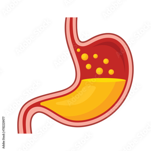 Gastroesophageal Reflux Disease. Stomach Icon. Vector