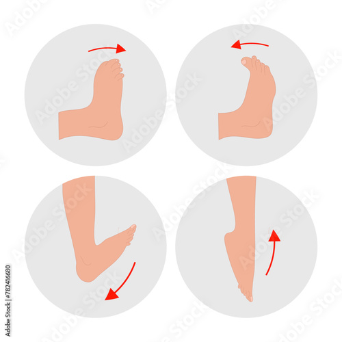 Special exercise for food deformation problem. Orthopedist Therapeutic and strengthening to bend foot up and down
