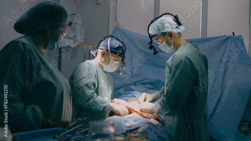 Professional surgeons doctors with assisting nurse perform surgical operation intensive therapy surgery treatment adipose liposuction patient health rescue in operating room healthcare hospital clinic