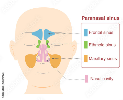Illustration of head with frontal view of sinuses