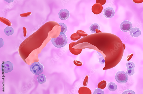 Hemolytic Anemia (HA) cells in the blood flow - closeup view 3d illustration photo