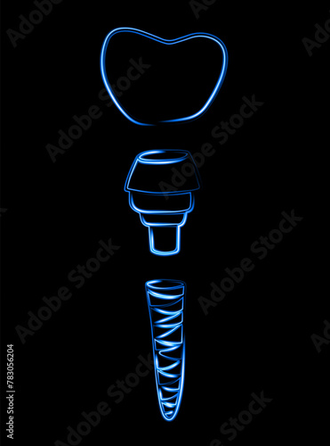 Vector isolated illustration of dental implant with neon effect.