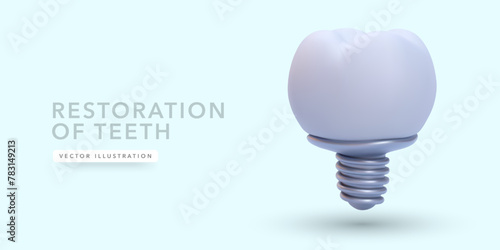Dental implant in realistic style isolated on light background. Vector illustration
