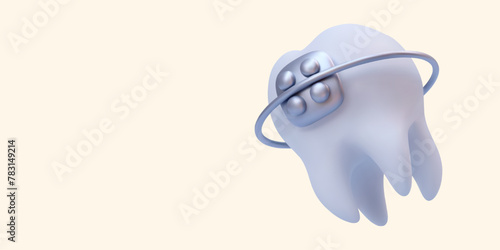 Oral health care concept with realistic tooth braces isolated on light background. Vector illustration