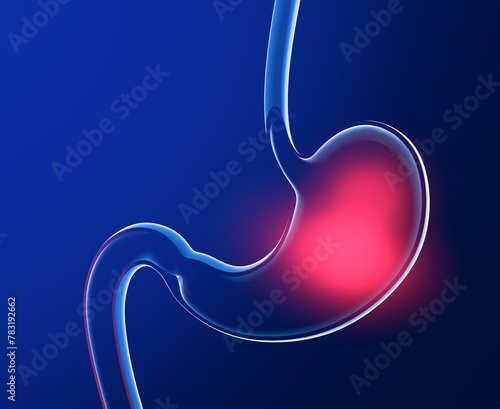 3D illustration of stomach with burning. Anatomical cut of transparent glass with lights and reflections on a dark blue background.