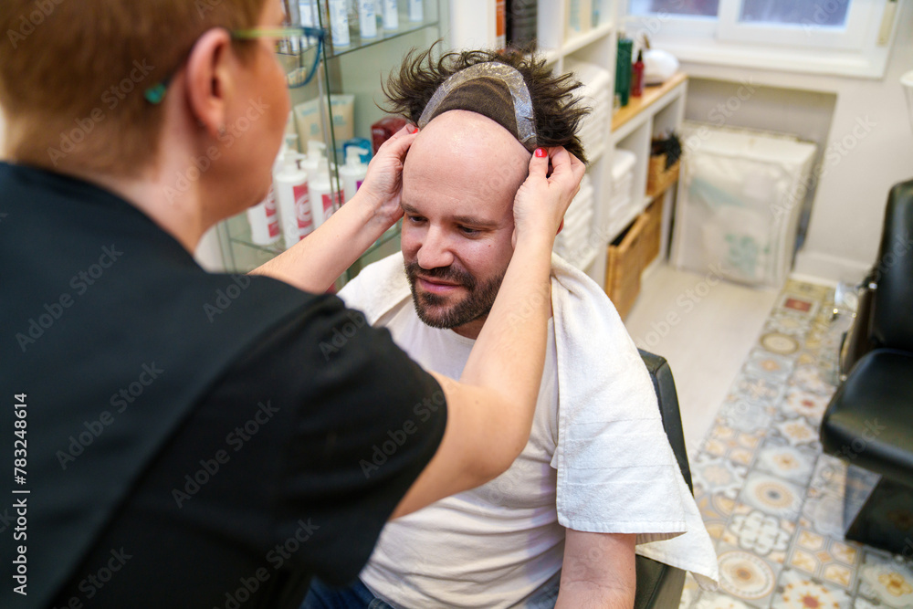 Obraz premium Adjusting hair prosthesis for a comfortable and natural fit.