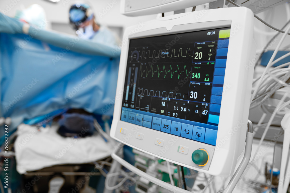 Monitor screen with vital sign and ECG data of patient during surgery inside operating room in hospital.Monitor people under anesthesia. showing patient heart rate and blood pressure Monitor screen with vital sign and ECG data of patient during surgery inside operating room in hospital.Monitor people under anesthesia. showing patient heart rate and blood pressure