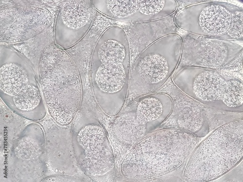 Nematode eggs with an elliptical shape, found in the cleavage stage and distributed across the nematode's body. photo