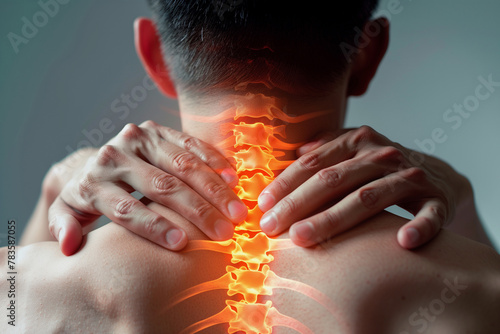 A man with his hands on his neck, with a spine that is red and orange. The spine is bent and twisted, and the man's hands are on it. Concept of discomfort and pain photo