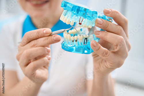 Foto Female dental technician showing tooth with caries or decay on 3d model