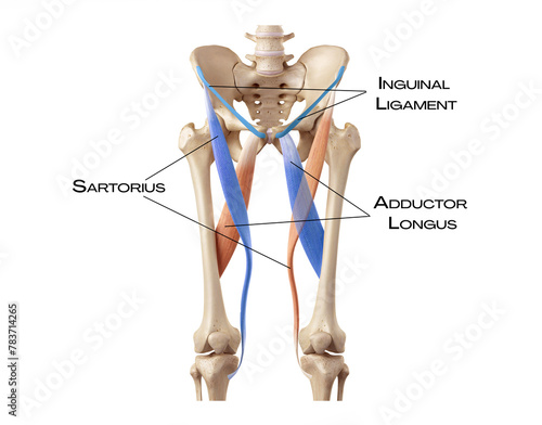 Canvas Print Femoral Triangle Boundaries - sartorius, adductor longus, inguinal ligament