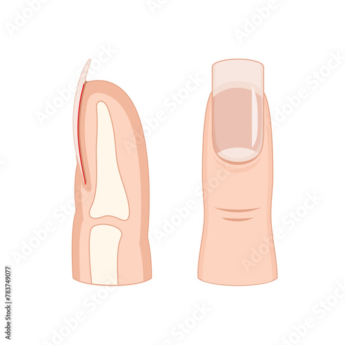 Anatomy and Physiology of the Fingertip-06 photo