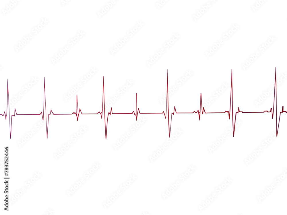 electrocard diagram on grid paper electrocard diagram on grid paper