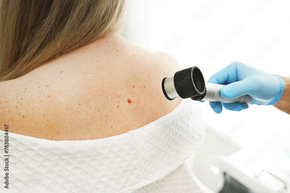 Naklejka premium a dermatologist examines moles and skin growths on the patient's body using a special device - a dermatoscope. Diagnosis and prevention of melanoma.
